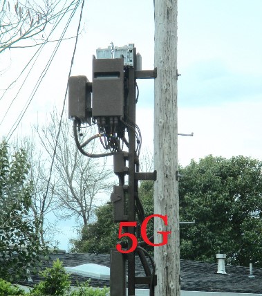 5g1